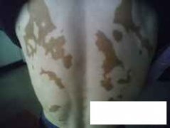 <font color='#000000'>ݿܺ</font>