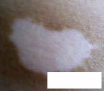 <font color='#000000'>ݰҽԺʲôط</font>
