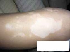 <font color='#000000'>ݰЩҽԺ</font>
