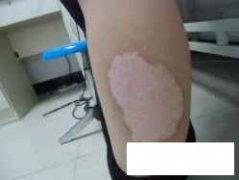 <font color='#000000'>ݰƵҽԺ</font>