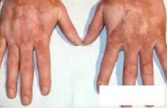 <font color='#000000'>ݰרҽԺ</font>