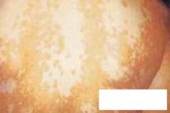 <font color='#000000'>ļҿ</font>