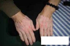 <font color='#000000'>ݿɶרҽԺЧ</font>
