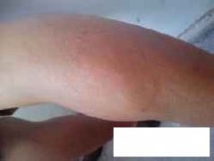 <font color='#000000'>ݰȨҽԺ</font>