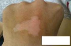 <font color='#000000'>ݰҽԺεĿ</font>