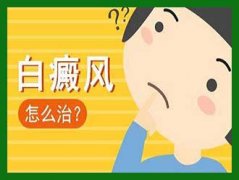 ʲôԭŮԻ˰缲